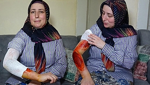 Korkunç olay! Eşini kaynar suyla yaktı