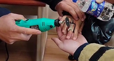 Parmağı metal halkaya sıkıştı, itfaiye ekipleri kurtardı