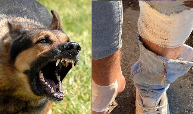 Aynı mahallede ikinci köpek saldırısı