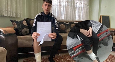 Köpeğin saldırdığı çocuk yaralandı